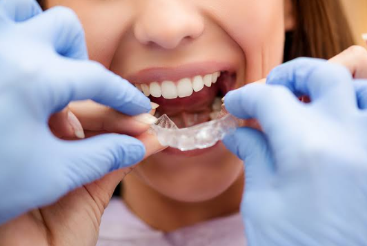 dentist placing invisalign clear braces in patients mouth