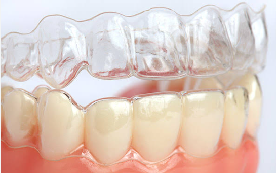 dummy teeth with invisalign clear braces in tarzana ca